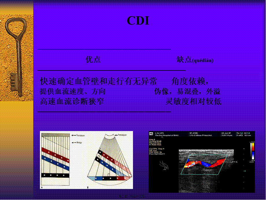 2022年医学专题—彩色多普勒超声在颈部血管的应用勇强.ppt_第2页