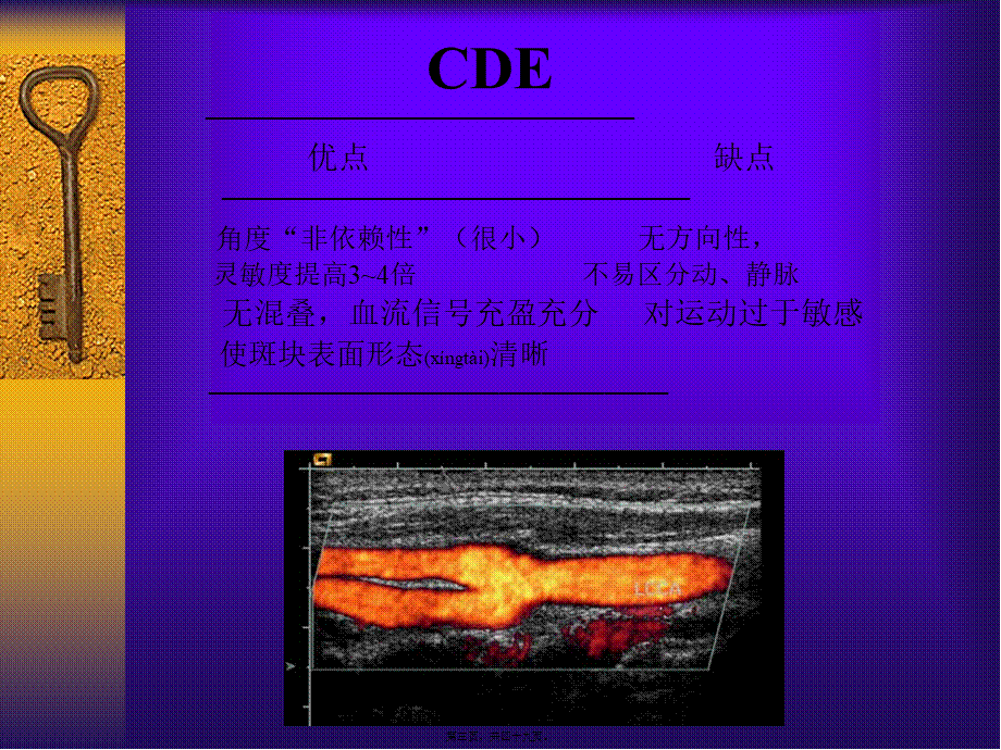 2022年医学专题—彩色多普勒超声在颈部血管的应用勇强.ppt_第3页