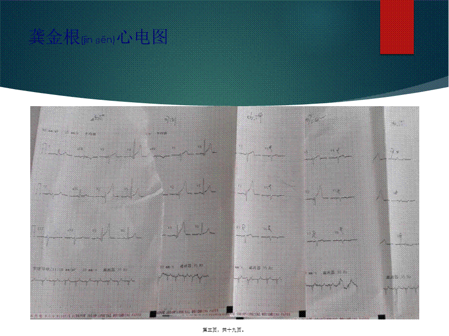 2022年医学专题—胸痛中心质量分析6.pptx_第3页