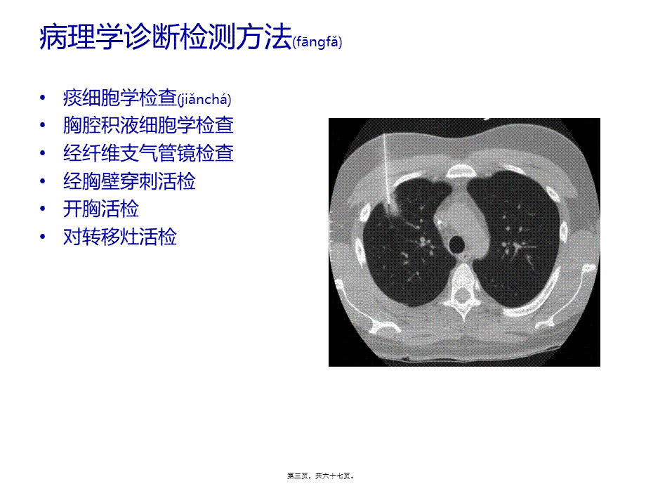 2022年医学专题—肺癌患者围术期处理新进展讲诉.ppt_第3页