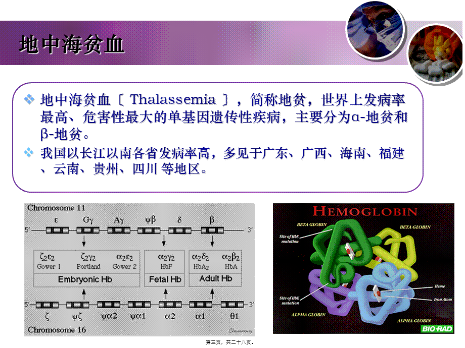 地中海贫血及新生儿筛查检测项目介绍.ppt_第3页