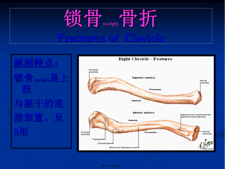 2022年医学专题—上肢损伤.ppt_第2页