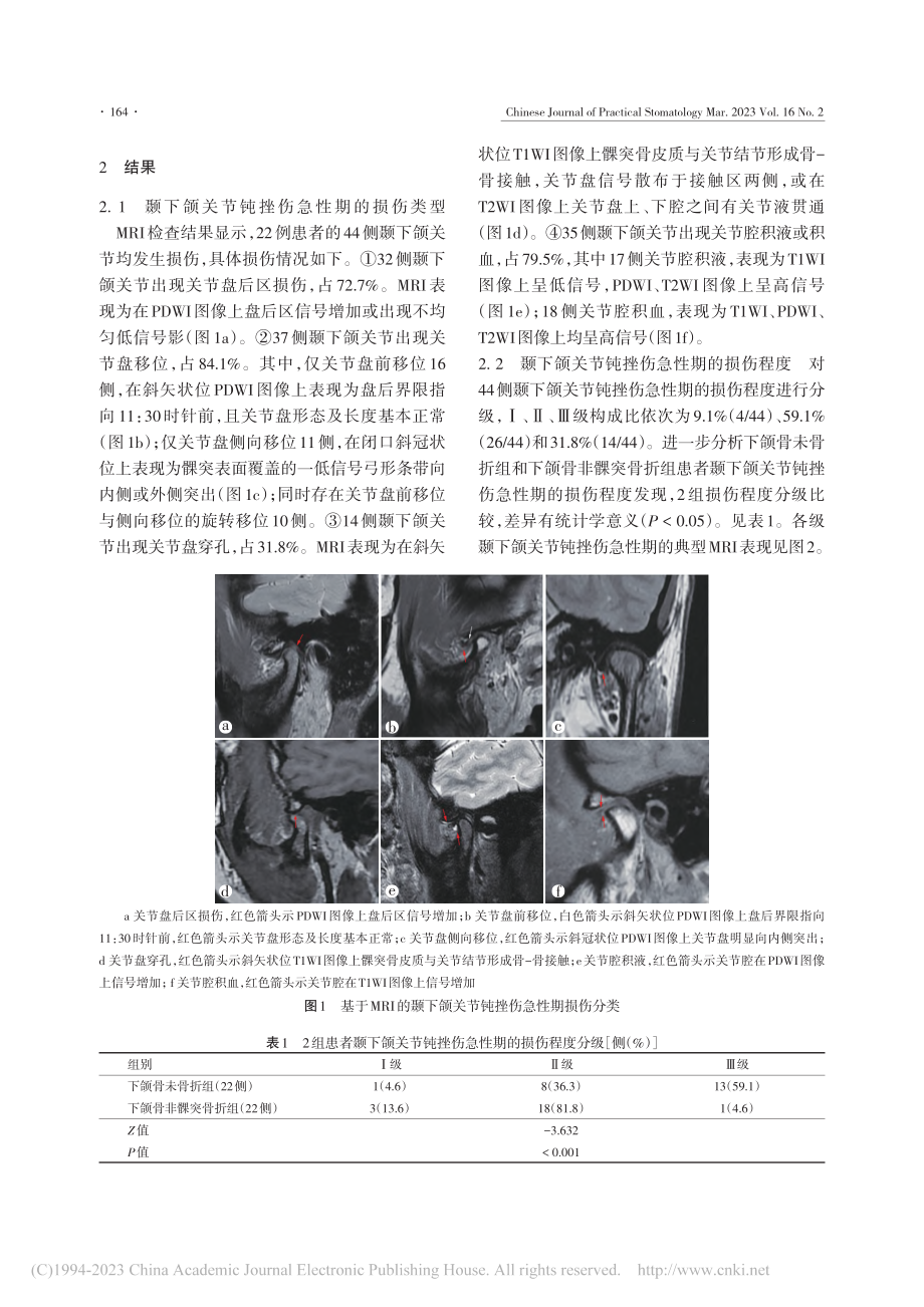 颞下颌关节钝挫伤急性期损伤程度的磁共振成像分析_贾晓庆.pdf_第3页