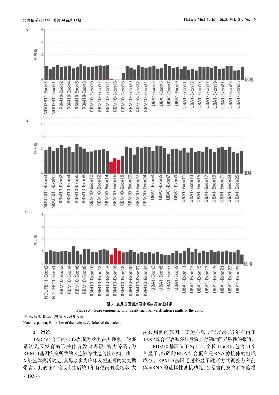 RBM10基因变异导致TARP综合征一例_夏倩.pdf_第3页