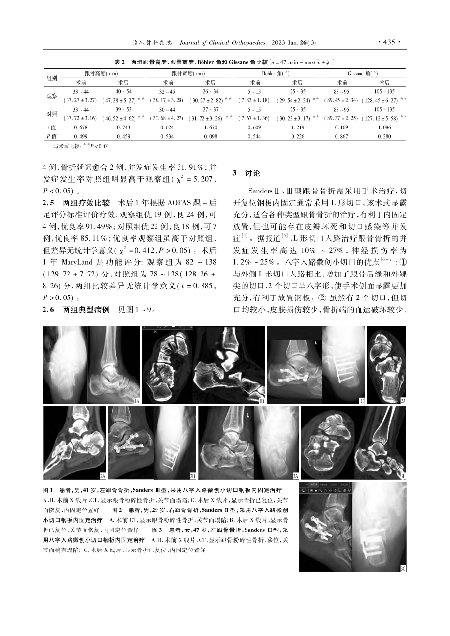 两种切口入路钢板内固定治疗跟骨骨折的疗效比较_薛兆龙.pdf_第3页