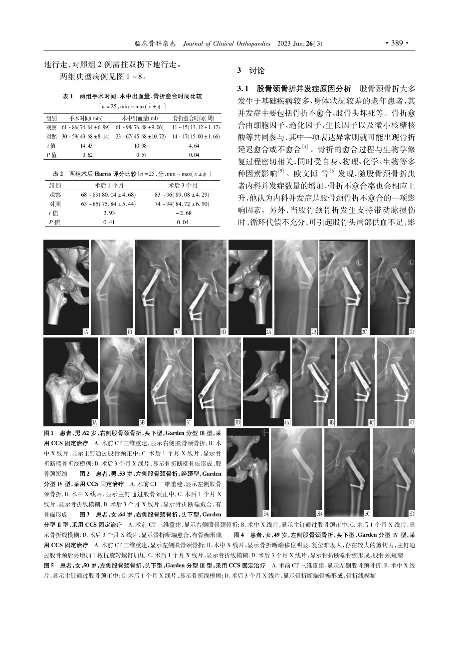 两种内固定方式治疗股骨颈骨折的疗效比较_徐鹏辉.pdf_第3页