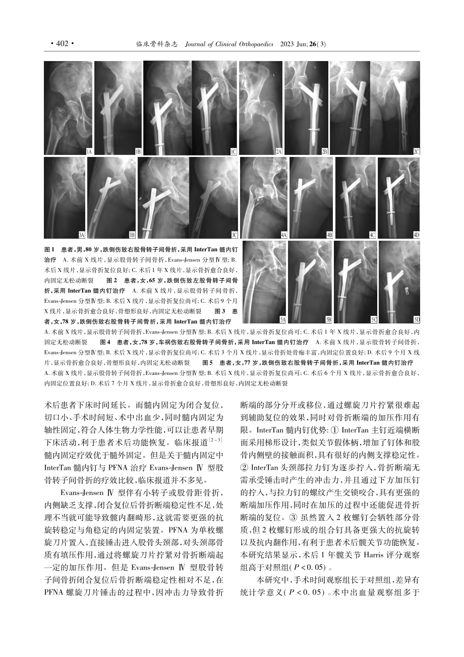 两种固定方式治疗老年股骨转子间骨折的疗效比较_朱健华.pdf_第3页