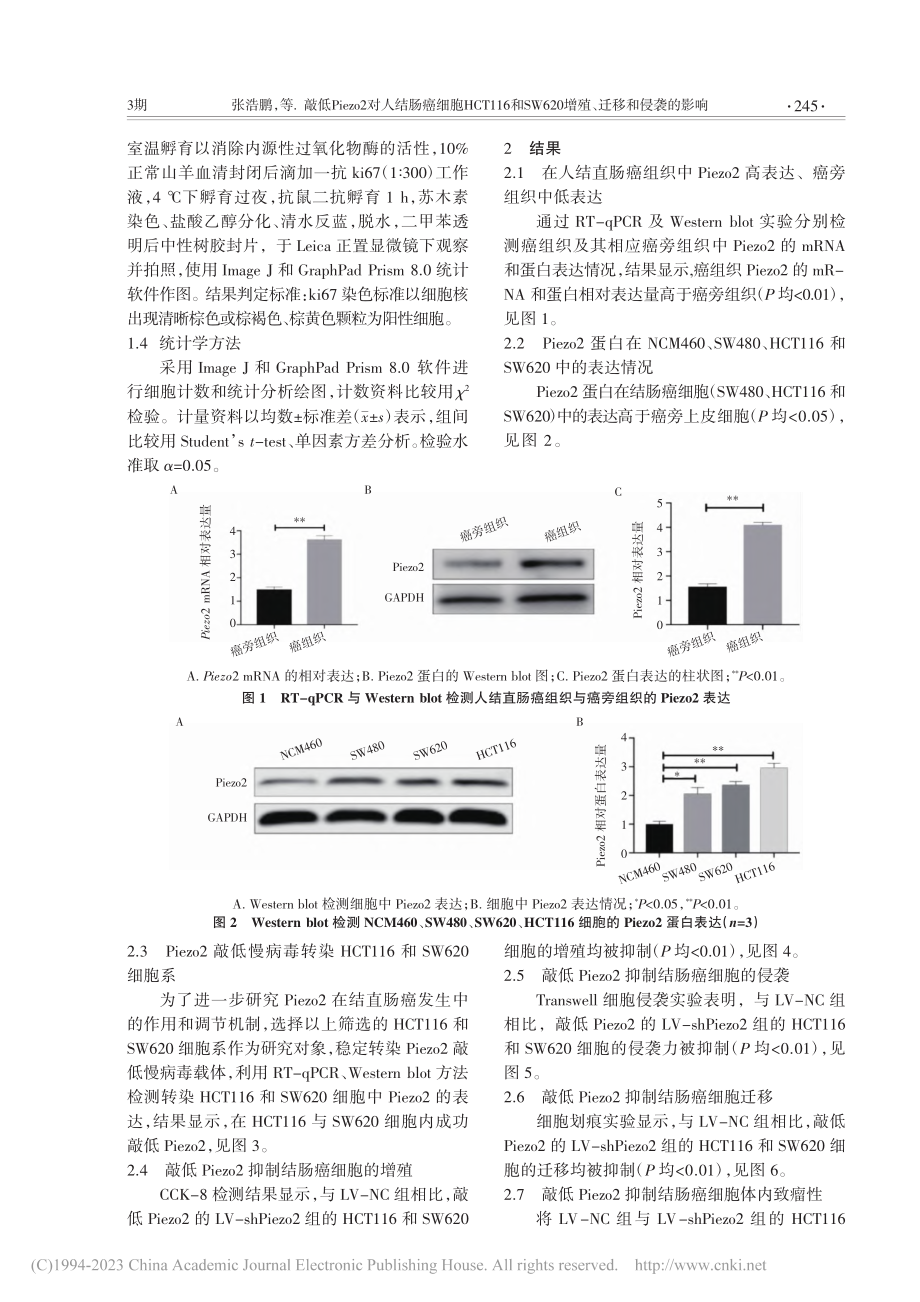 敲低Piezo2对人结肠癌...20增殖、迁移和侵袭的影响_张浩鹏.pdf_第3页