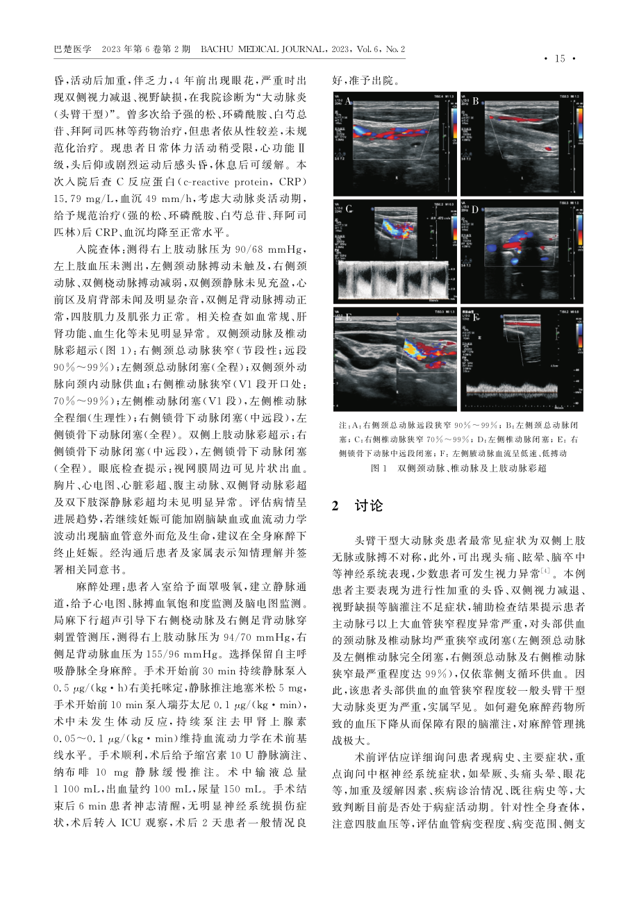 妊娠合并头臂干型大动脉炎患者行全身麻醉下人工流产术1例.pdf_第2页