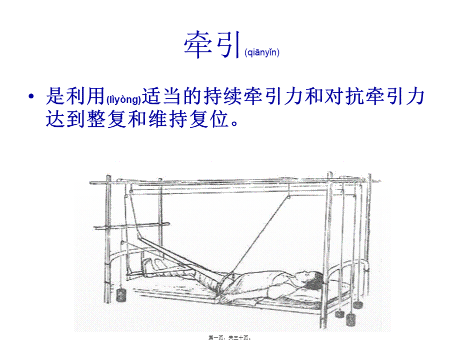 2022年医学专题—如小儿股骨干骨折用垂直悬吊皮牵引.ppt_第1页