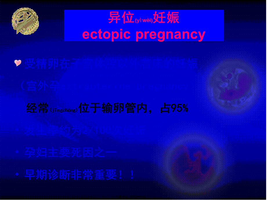 2022年医学专题—异位妊娠ep--new.ppt_第1页