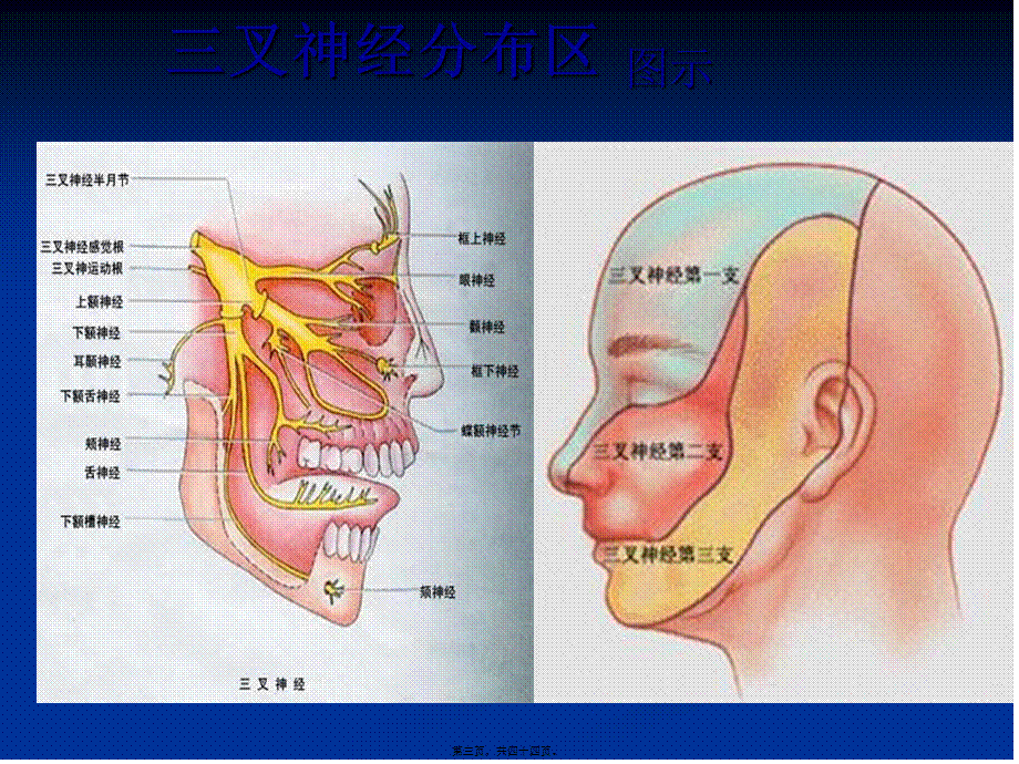 三叉神经痛(讲).pptx_第3页