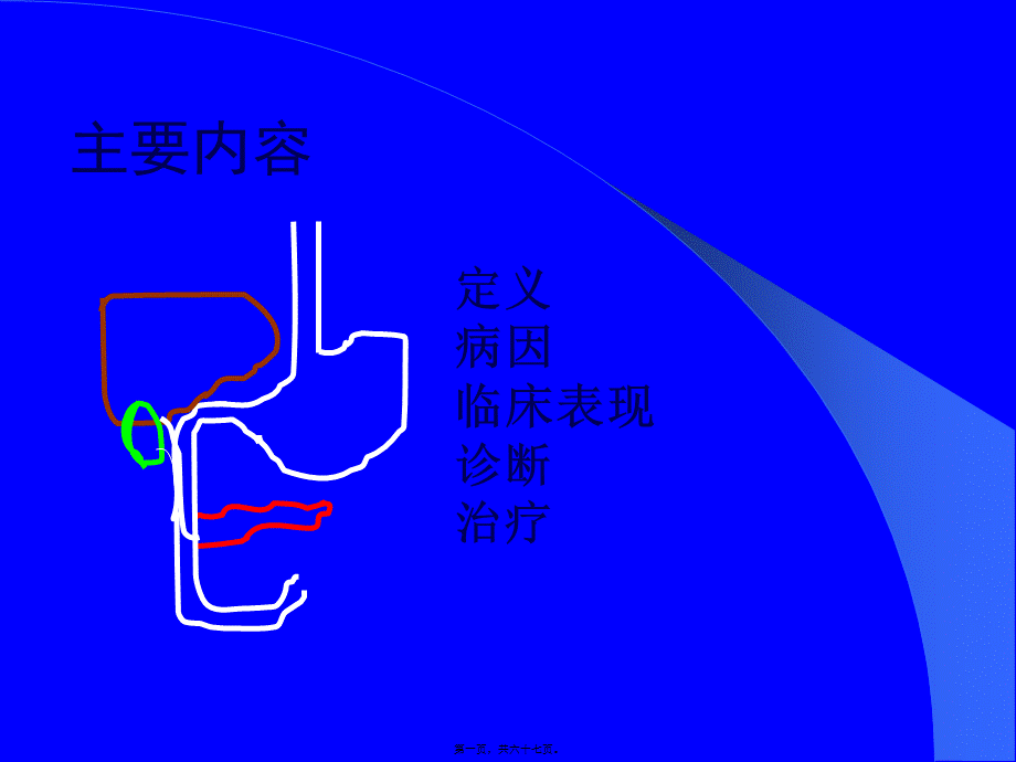 上消化道出血的处理(武希润).pptx_第1页