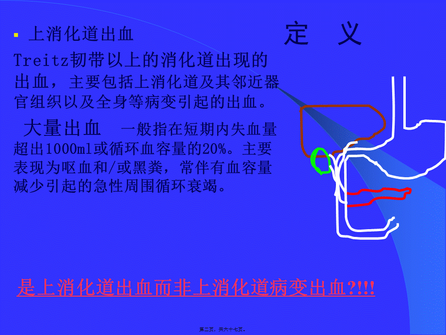 上消化道出血的处理(武希润).pptx_第2页