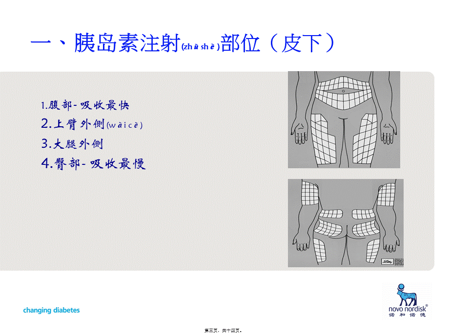 2022年医学专题—胰岛素注射.ppt_第3页