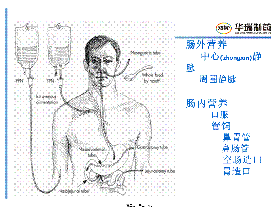 2022年医学专题—肠外营养配制——转发.ppt_第2页