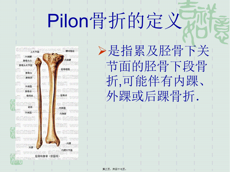 Pilon骨折的诊治现状与进展.pptx_第2页