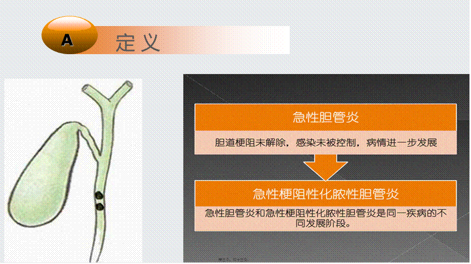 2022年医学专题—急性梗阻化脓胆管炎.pptx_第3页