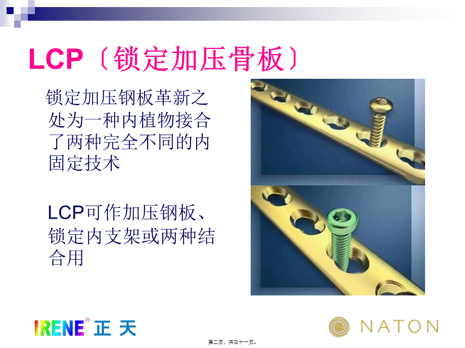 LCP系统接骨板的注意问题及常见问题(免金币).pptx_第2页