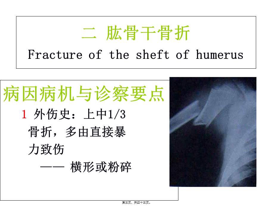 6.2第六章-第二节上肢骨折.pptx_第3页