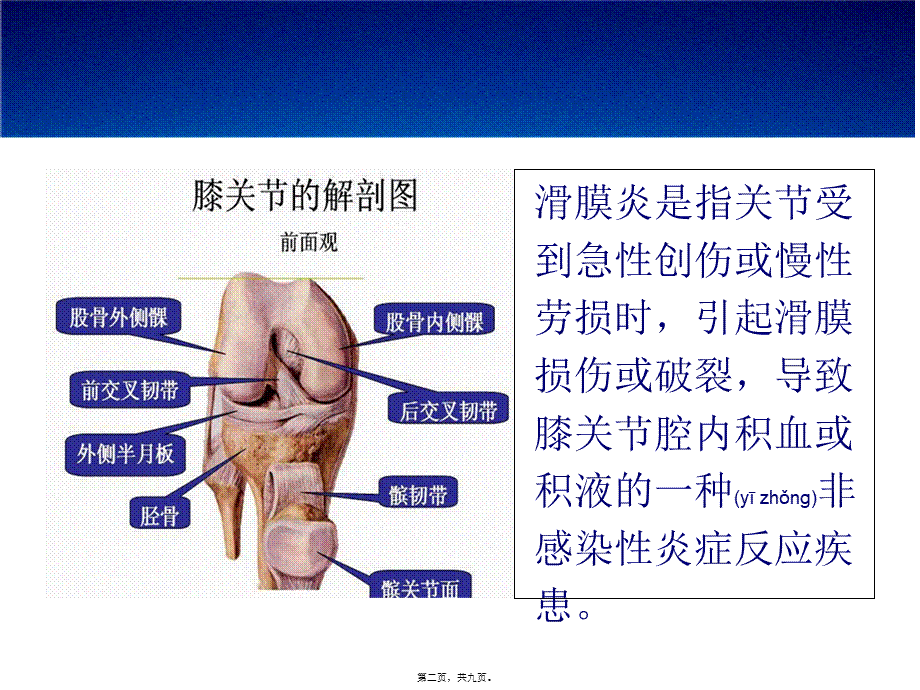 2022年医学专题—滑膜炎症状汇编.ppt_第2页