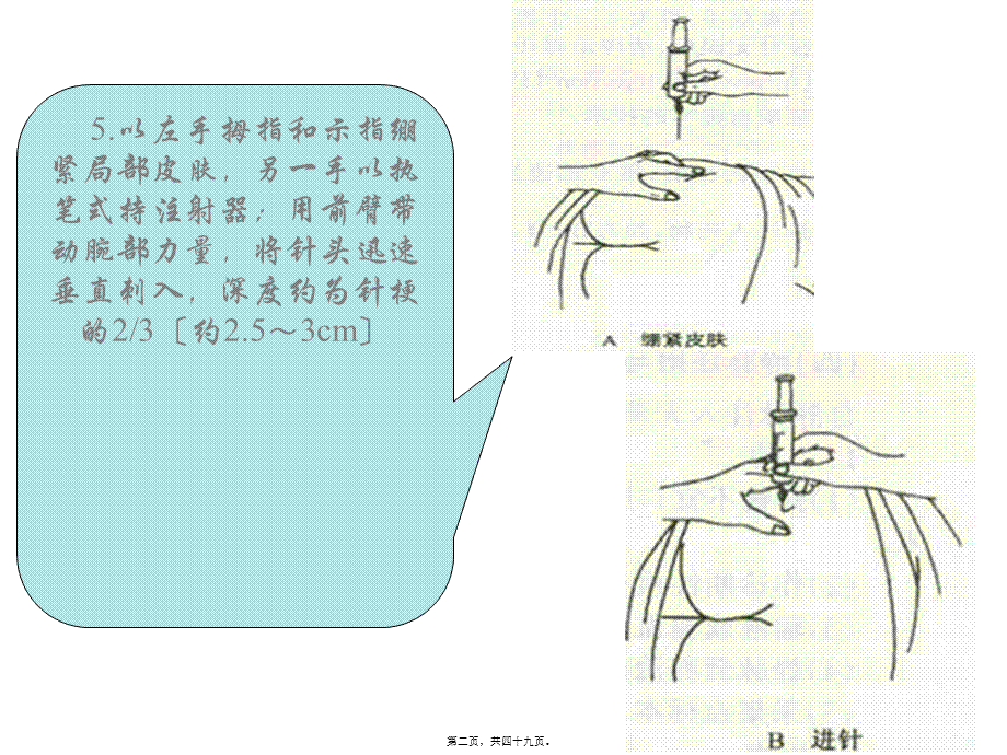 5以左手拇指和示指绷紧局部皮肤-另一手以执笔式持注射器.pptx_第2页