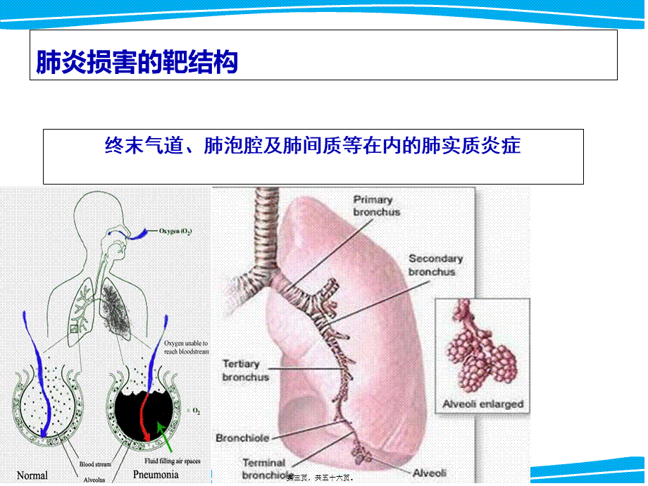 严重肺部感染诊治策略.pptx_第3页