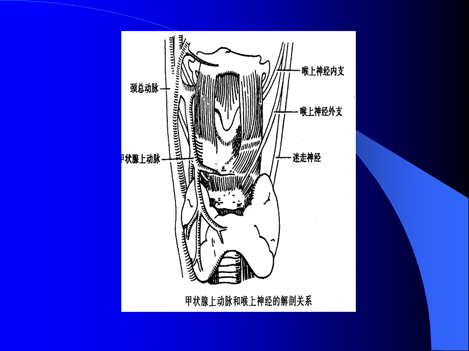 64内分泌科-甲状腺和乳腺疾病的外科治疗(1).ppt_第3页