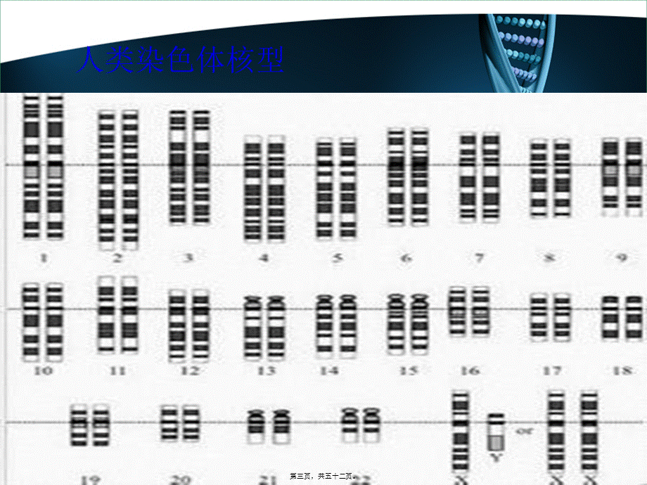 X染色体遗传病.pptx_第3页