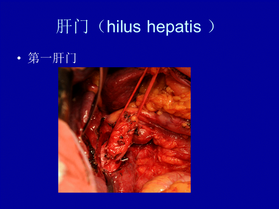 76内科-肝脏疾病(1).ppt_第3页