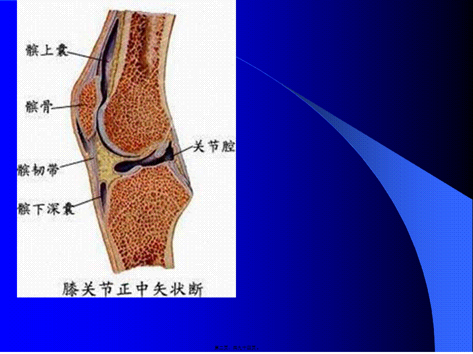 2022年医学专题—膝关节MRI检查.ppt_第2页