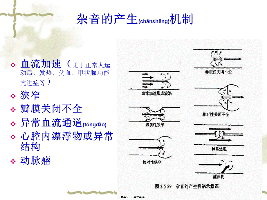 2022年医学专题—心脏听诊.ppt_第3页