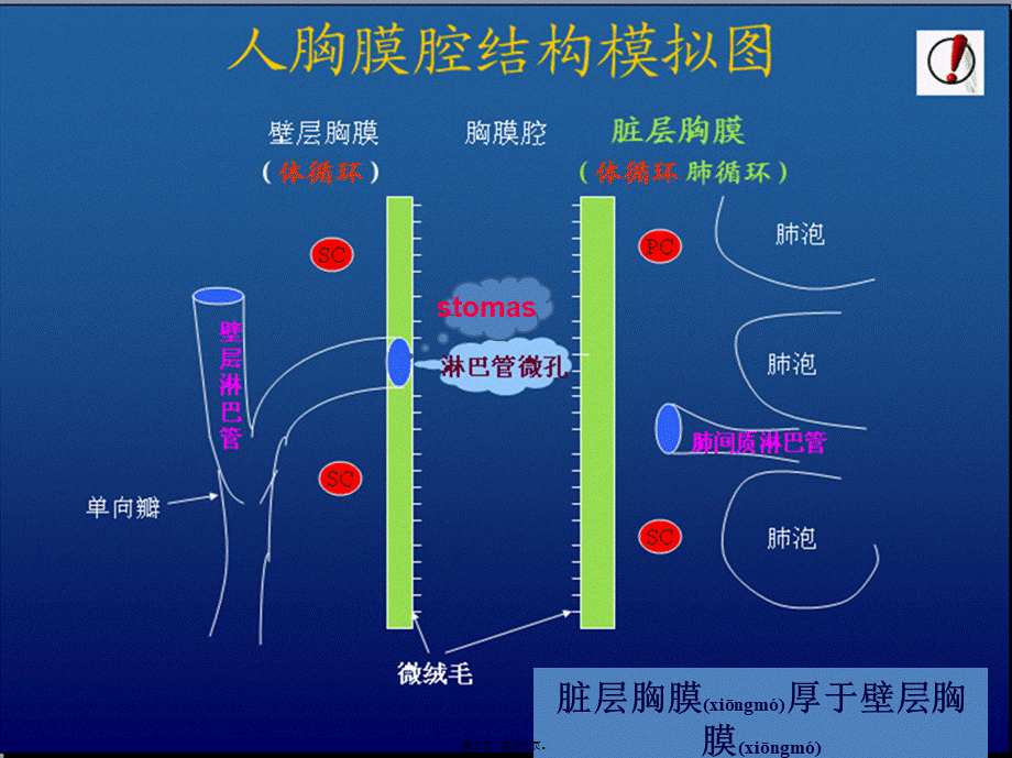 2022年医学专题—胸腔积液-zjy.ppt_第2页