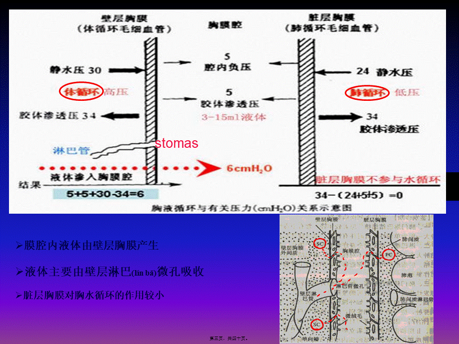 2022年医学专题—胸腔积液-zjy.ppt_第3页