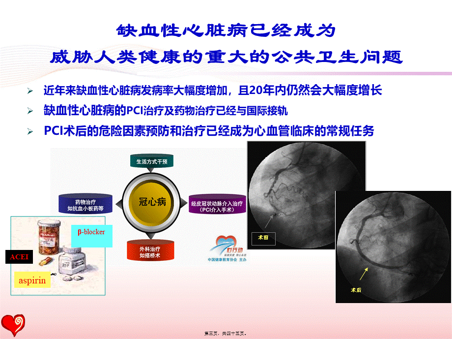 PCI术后患者的心脏康复--指南与现实(2016盛京会).pptx_第3页