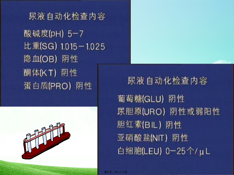 2022年医学专题—尿常规和粪常规解读.ppt_第2页