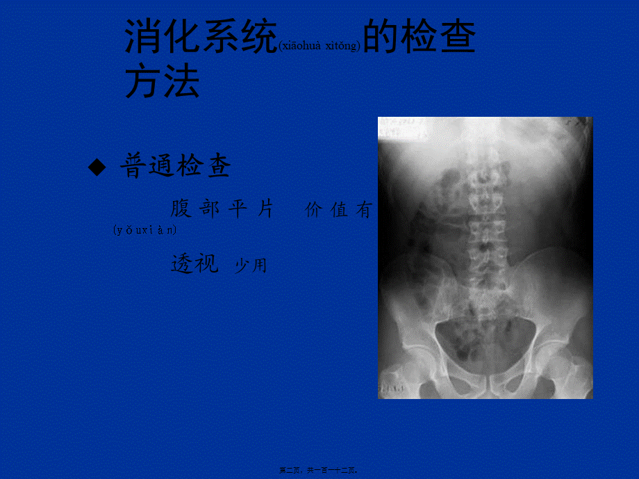 2022年医学专题—胃肠道CT检查.ppt_第2页