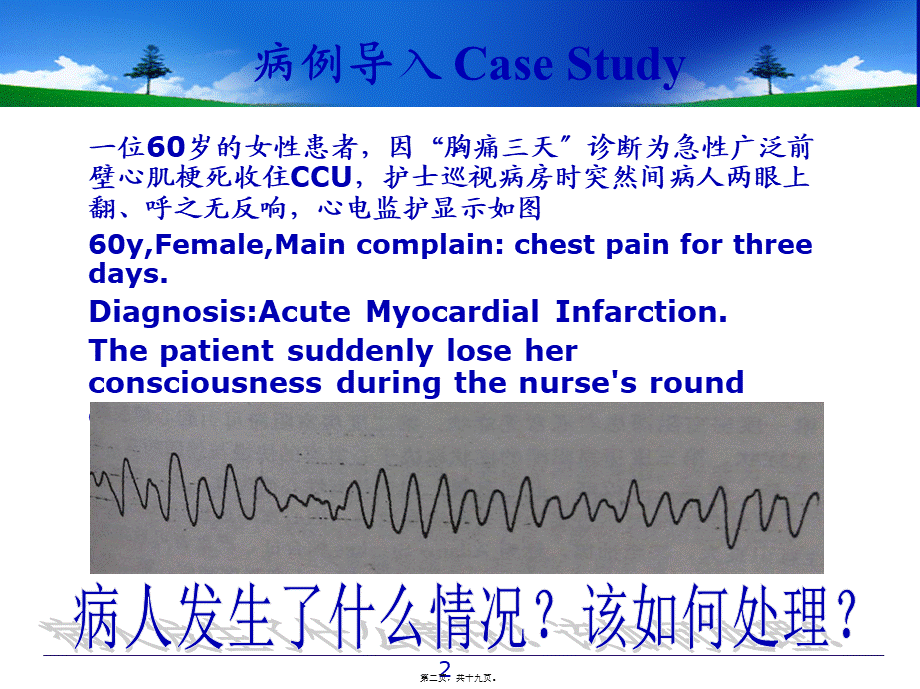 室颤与急救.pptx_第2页