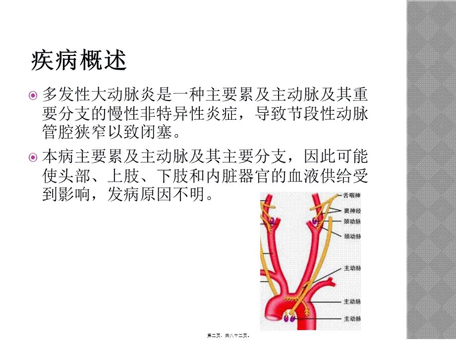 多发性大动脉炎.ppt_第2页