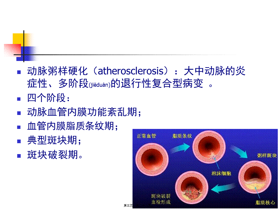 2022年医学专题—人卫第七版营养与动脉粥样硬化性心脏病.ppt_第3页