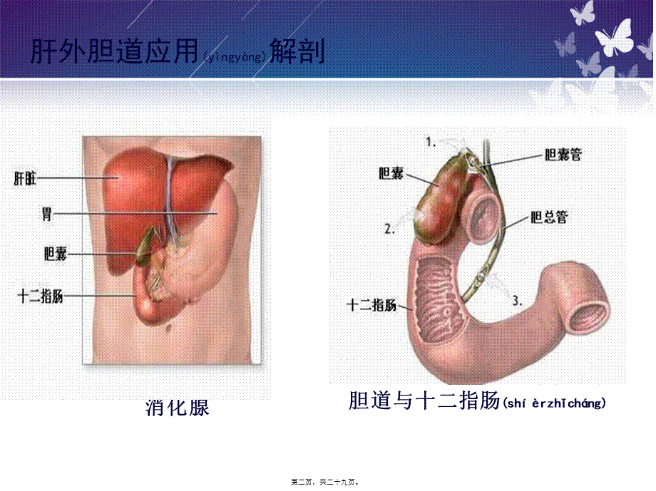 2022年医学专题—胆囊切除术教学查房.ppt_第2页