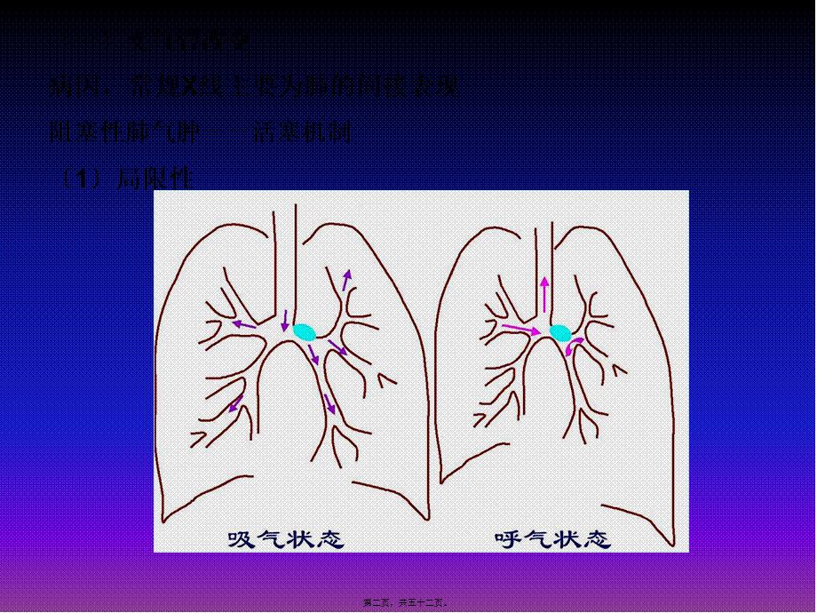 呼吸系统X线基本病变.pptx_第2页