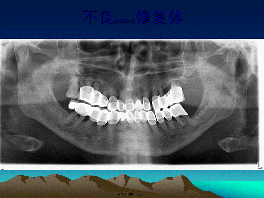 2022年医学专题—口腔科门诊常见影像.ppt_第2页