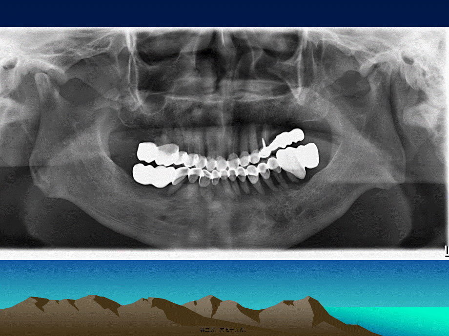 2022年医学专题—口腔科门诊常见影像.ppt_第3页