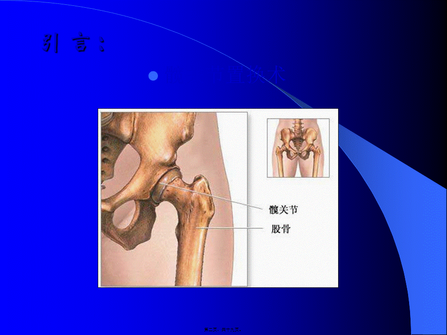 2022年医学专题—第三篇：髋关节查房.ppt_第2页