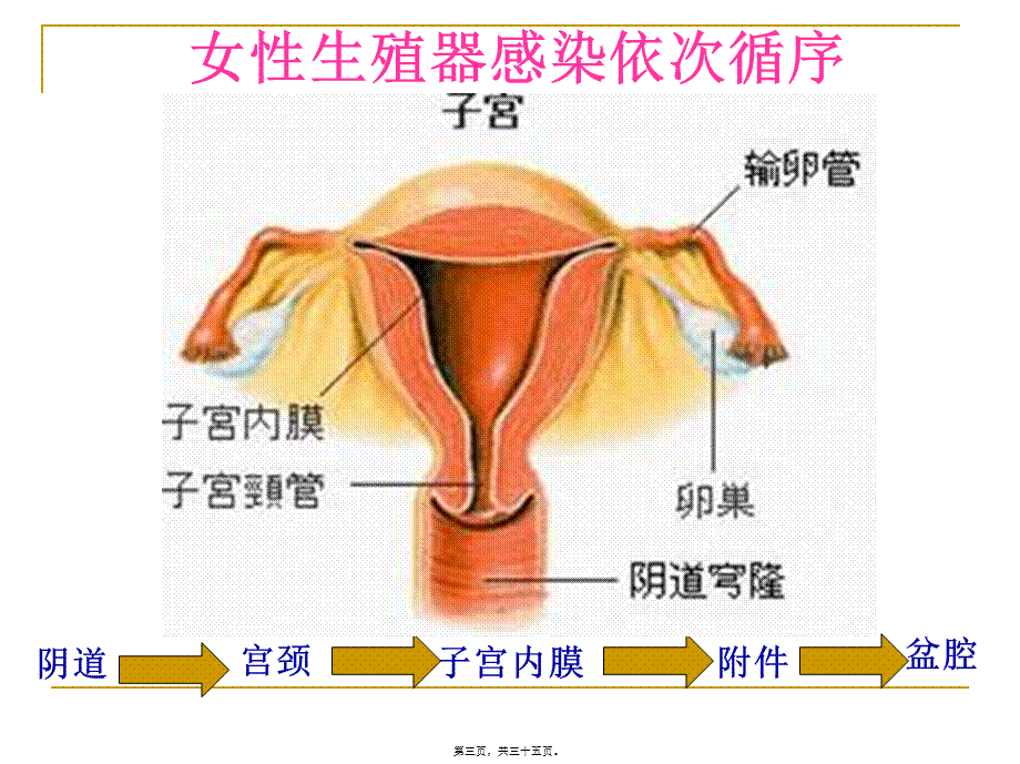 宫颈炎、附件炎、盆腔炎....pptx_第3页