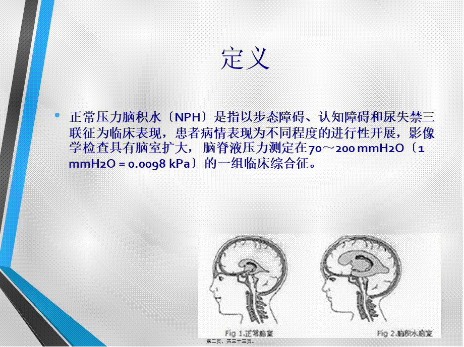 中国特发性正常压力脑积水诊治专家共识(2016).pptx_第2页