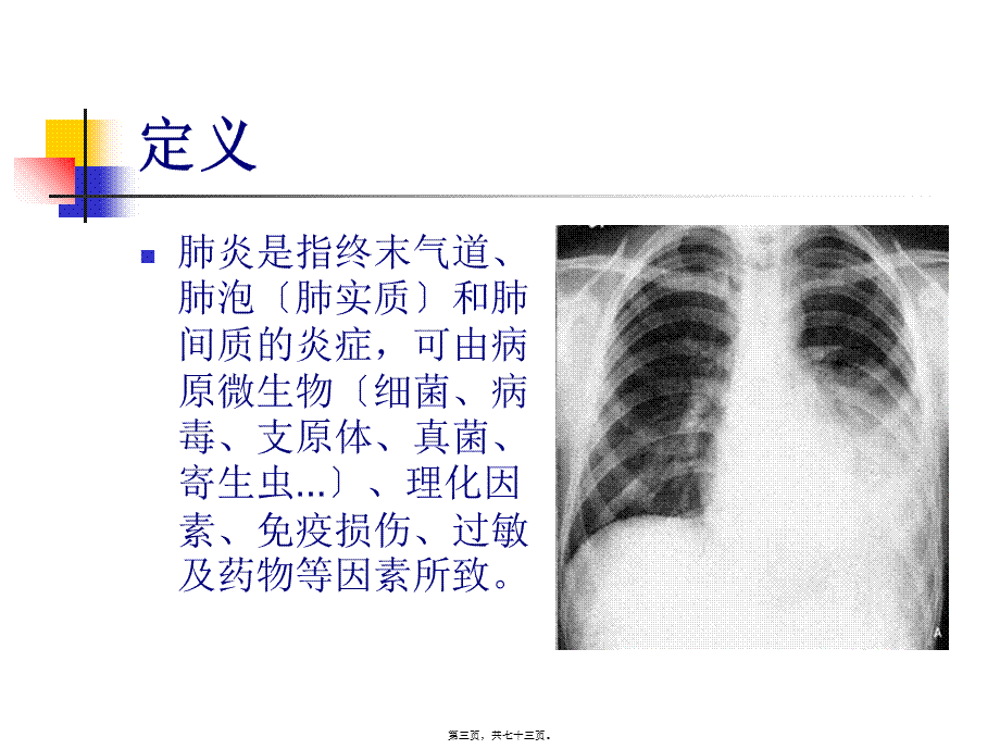 9.肺炎概述.pptx_第3页