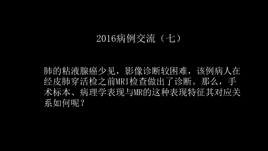 一例肺粘液腺癌综合影像及病理学回顾(1).pptx_第2页