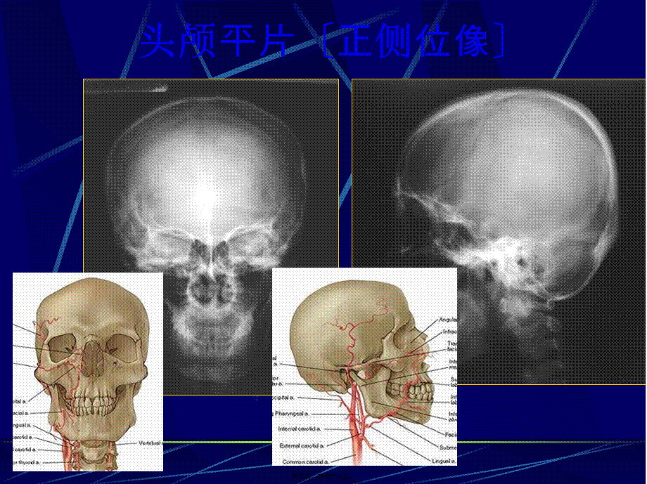 中枢神经系统正常及异常影像改变(北京协和医院).pptx_第3页